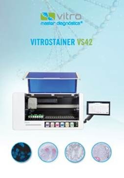 https://vitro.bio/wp-content/uploads/2025/12/Imagen10.jpg