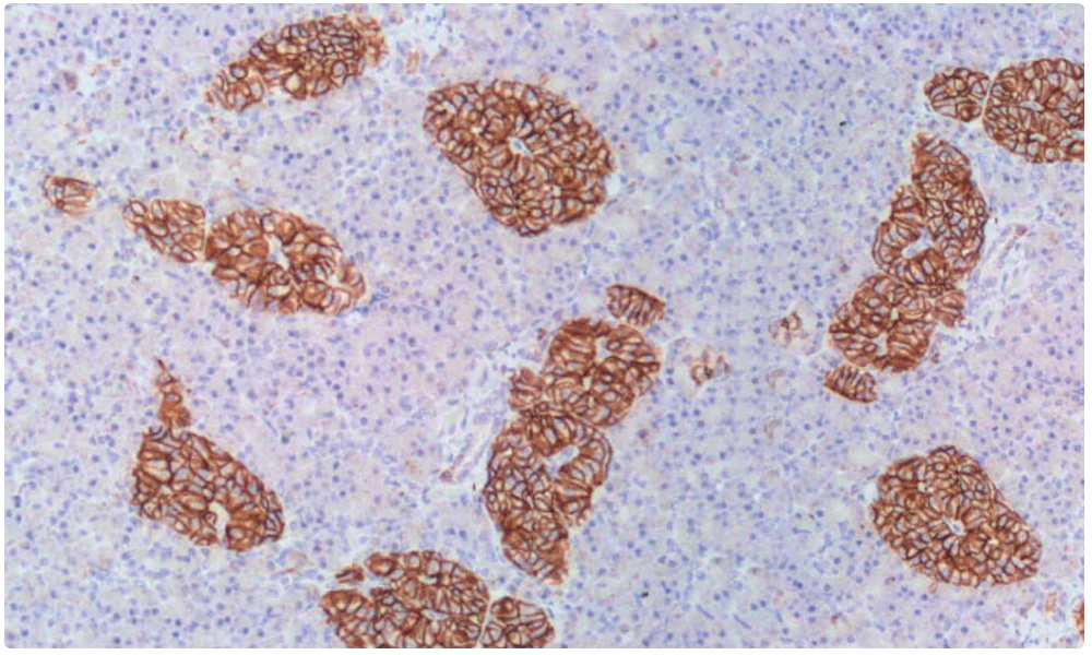Cabecera Enfermedades Infecciosas