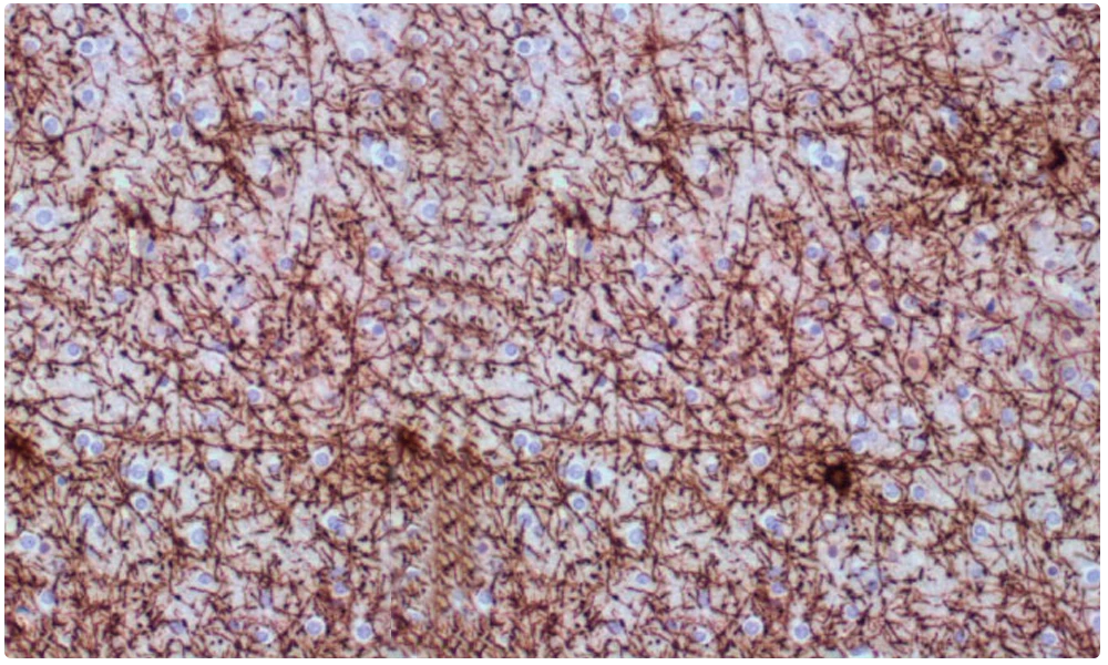 Cabecera Neuropatologia