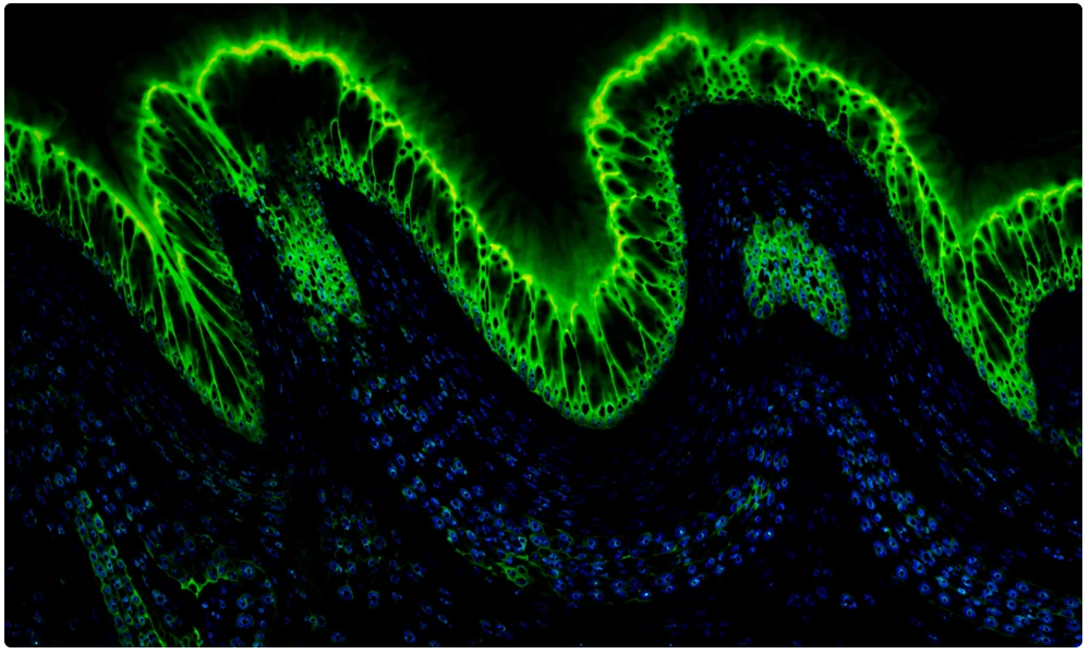 Cabeceras Aplicaciones Diagnosticas
