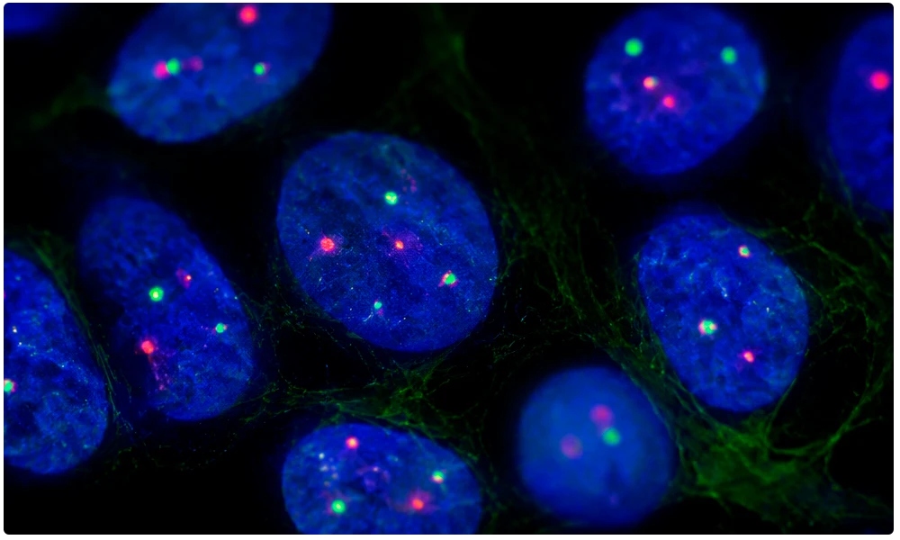Cabeceras Reproduci