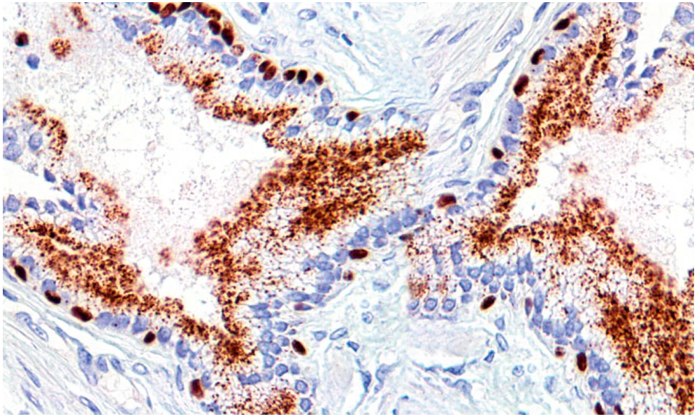 Cabeceras Uropatologia
